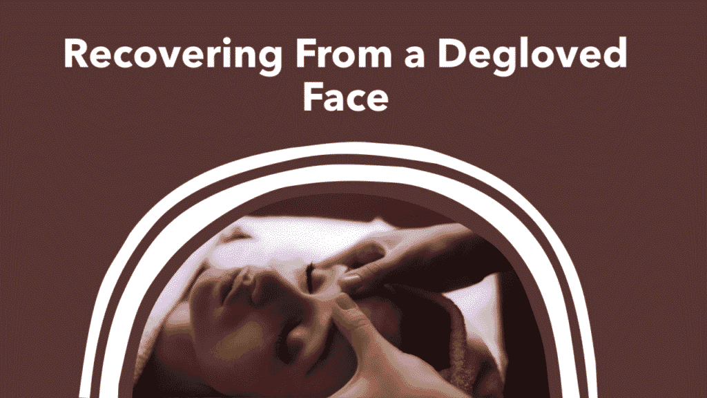 Degloved Face