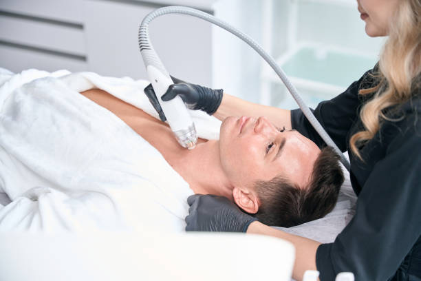 Potenza RF Microneedling